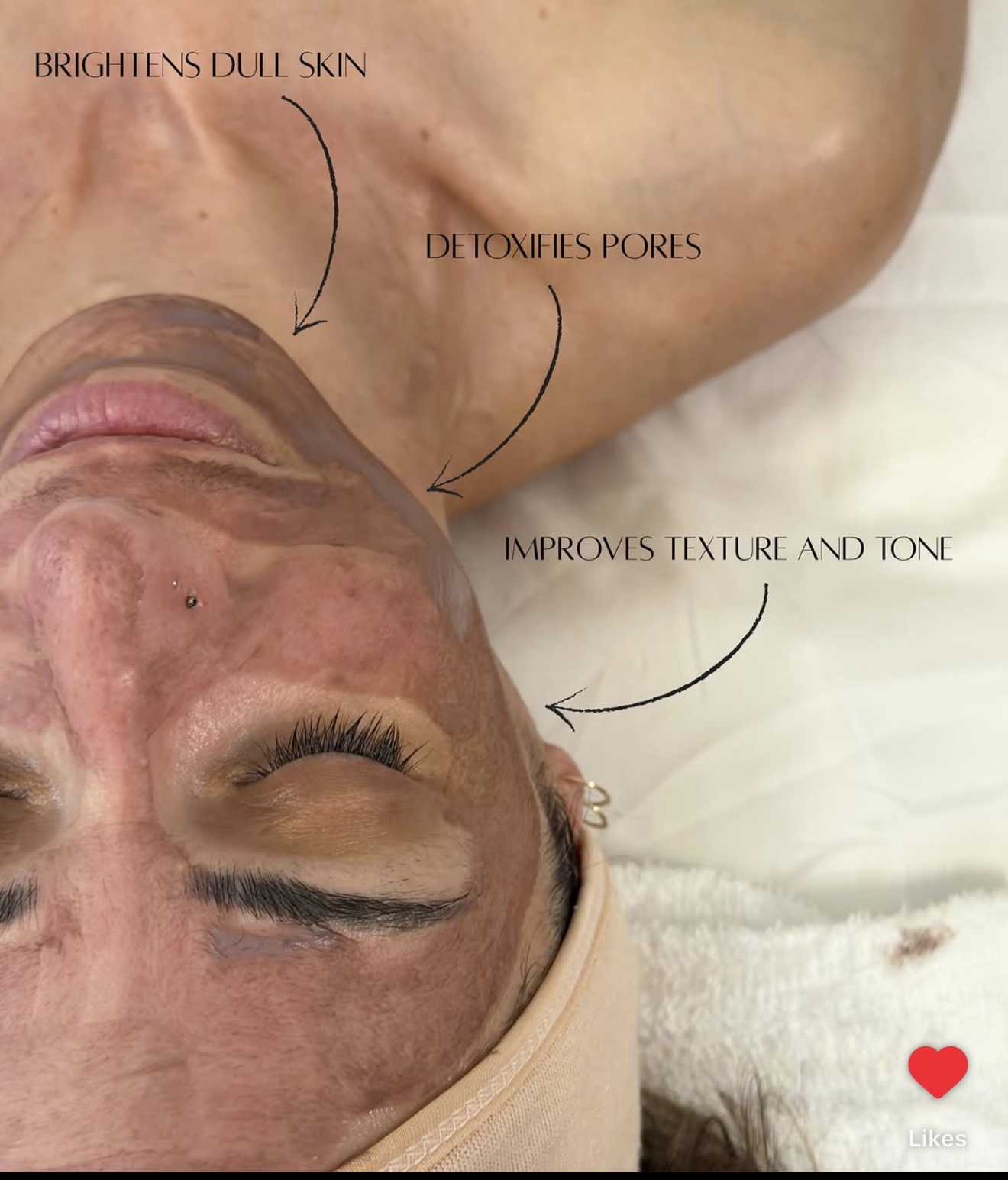 The Gut-Skin Connection: How Your Digestive Health May Be Showing Up on Your Face – Part 1 of Paradise Medical’s 3-Part Gut & Skin Series