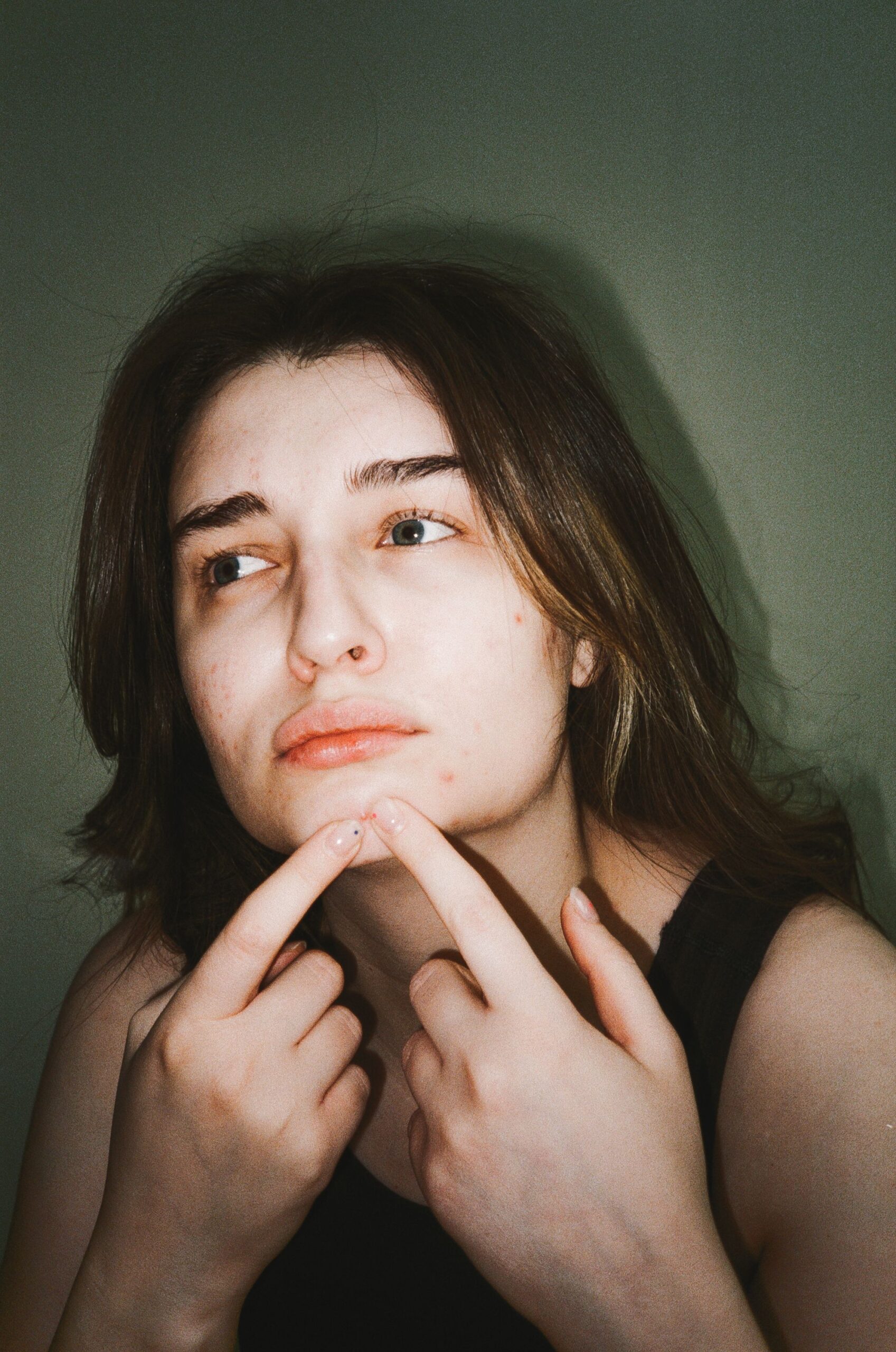 Acne Awareness Month: Understanding Acne from the Inside Out